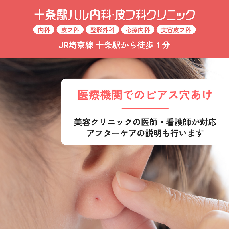 ピアッシング|ピアスの穴あけ(耳)