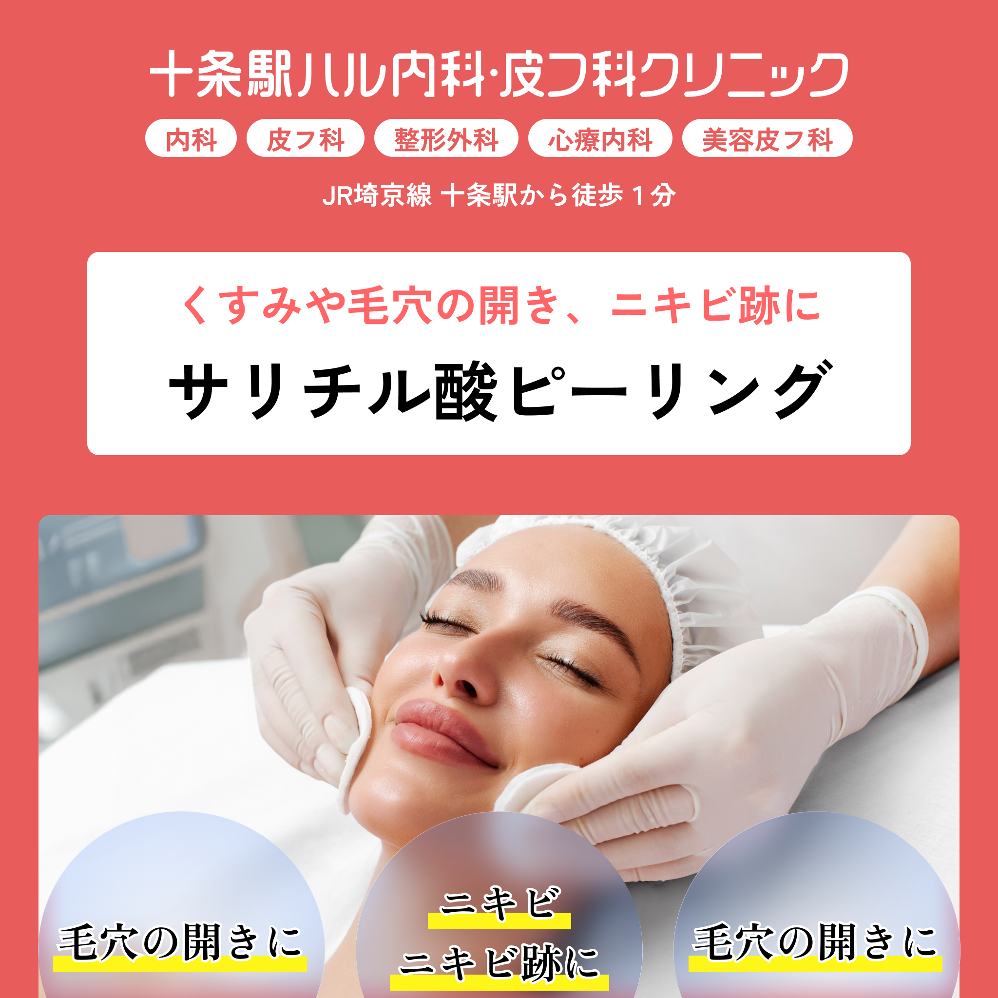 十条駅ハル内科・皮フ科クリニック｜サリチル酸ピーリング｜くすみや毛穴の開き、ニキビ跡に